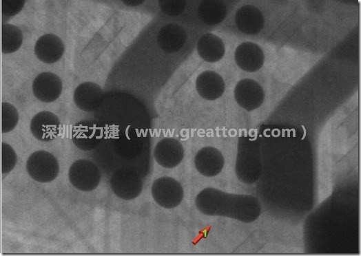 BGA因?yàn)楹笁|變小，造成錫膏過多而最終形成焊接短路的結(jié)果。